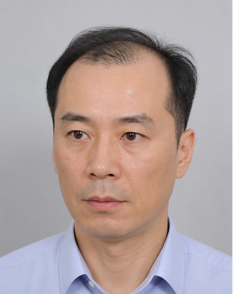 佩戴前 — 王先生 M 型发际线后移